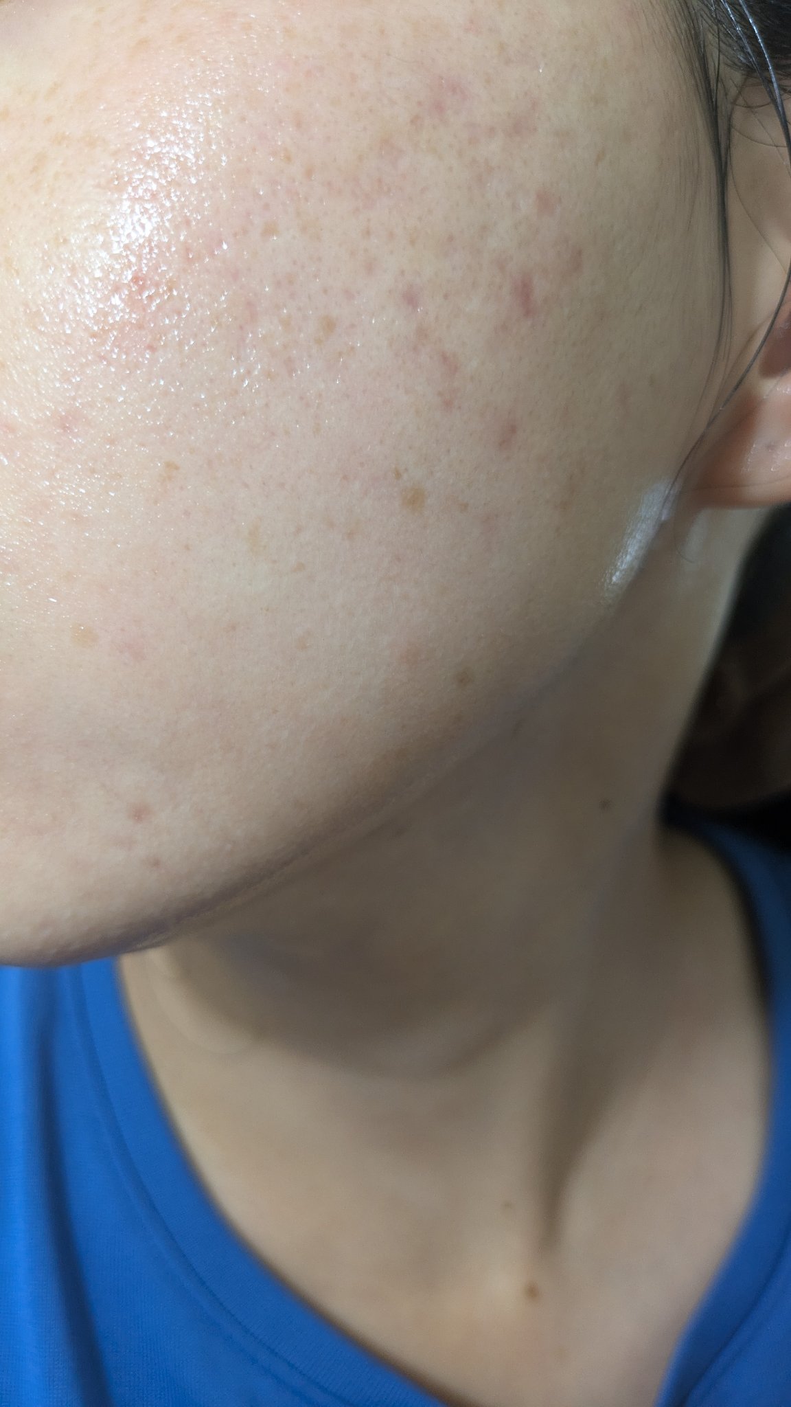 N10+Z1フェイスセラム /The Ordinary/美容液を使ったクチコミ（2枚目）