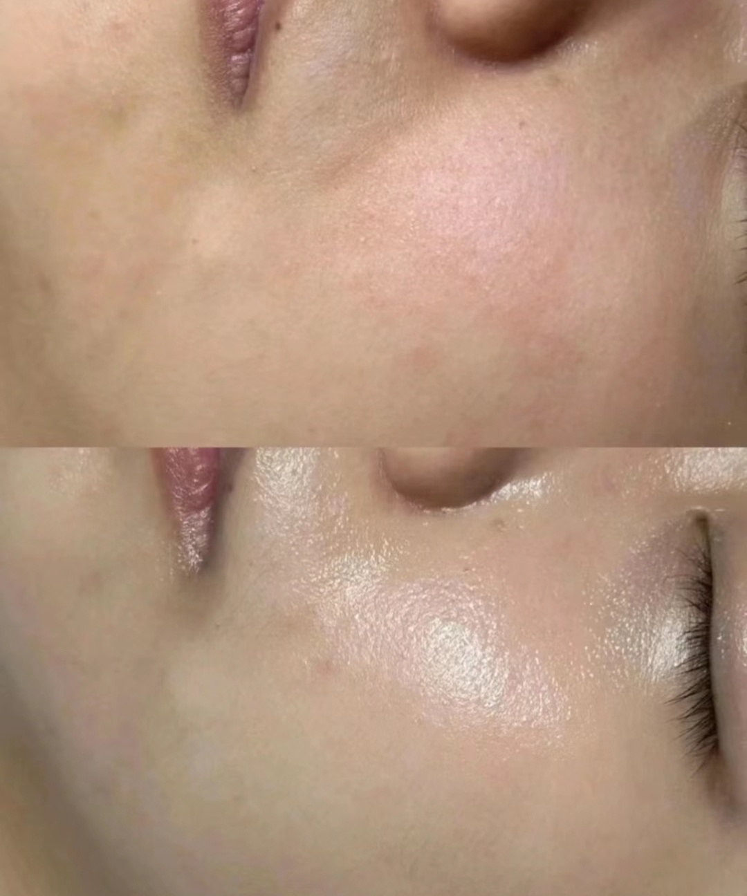 レチノールシカEGFリペアクリーム/DERMA RESEARCH/フェイスクリームを使ったクチコミ（1枚目）