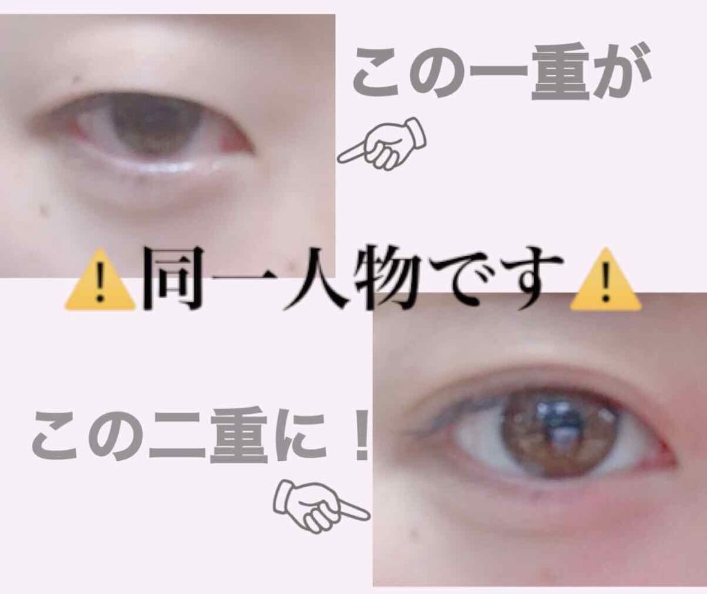 ワンダーアイリッドテープ リタッチボンド/D-UP/二重まぶた用アイテムを使ったクチコミ（1枚目）