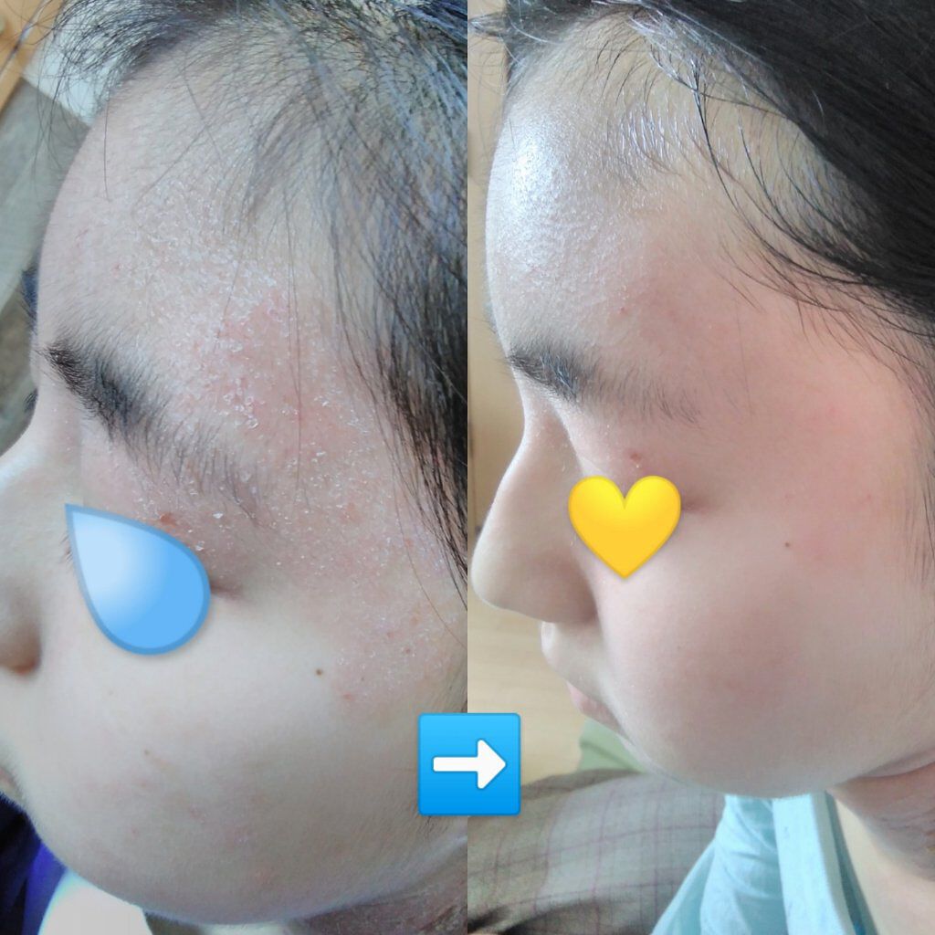 ファンチルフェイシャルソープ/HWANGCHIL/洗顔石鹸を使ったクチコミ（1枚目）