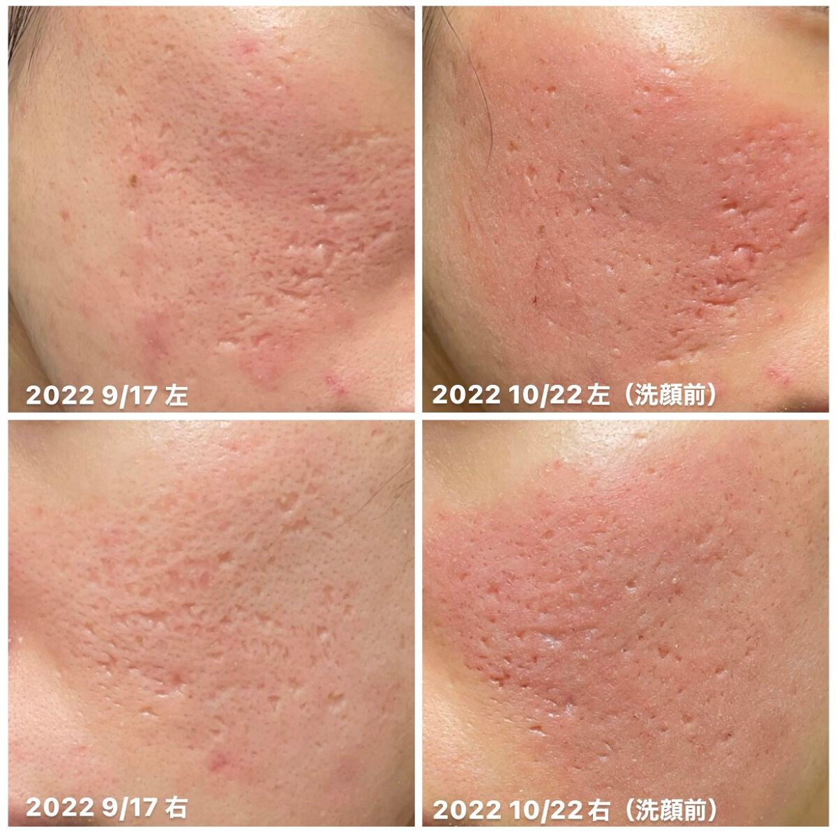 ティーツリーケアソリューション アンプルマスクJEX/MEDIHEAL/シートマスク・パックを使ったクチコミ(1枚目)