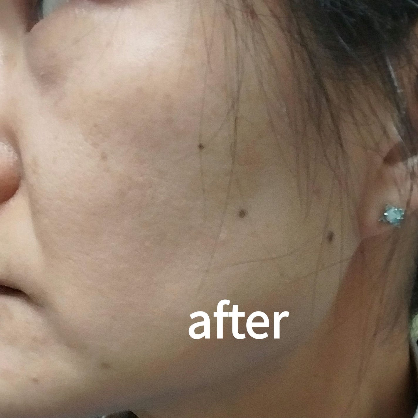 ユース ラディアンス ビタチノール セラム/primera/美容液を使ったクチコミ(4枚目)