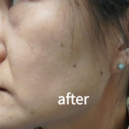 ユース ラディアンス ビタチノール セラム/primera/美容液を使ったクチコミ(4枚目)