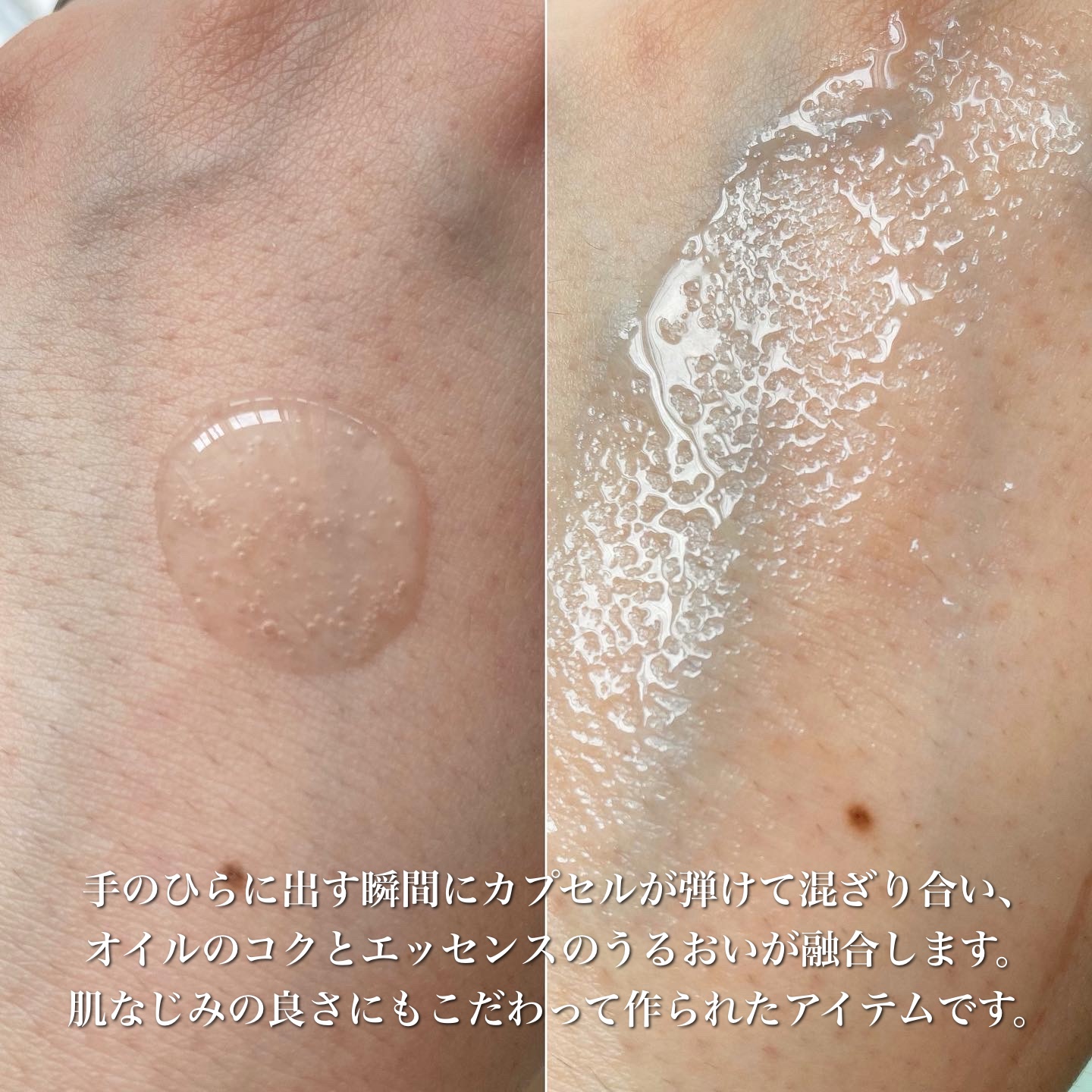 アンリミテッド キー/インフィニティ/美容液を使ったクチコミ（2枚目）