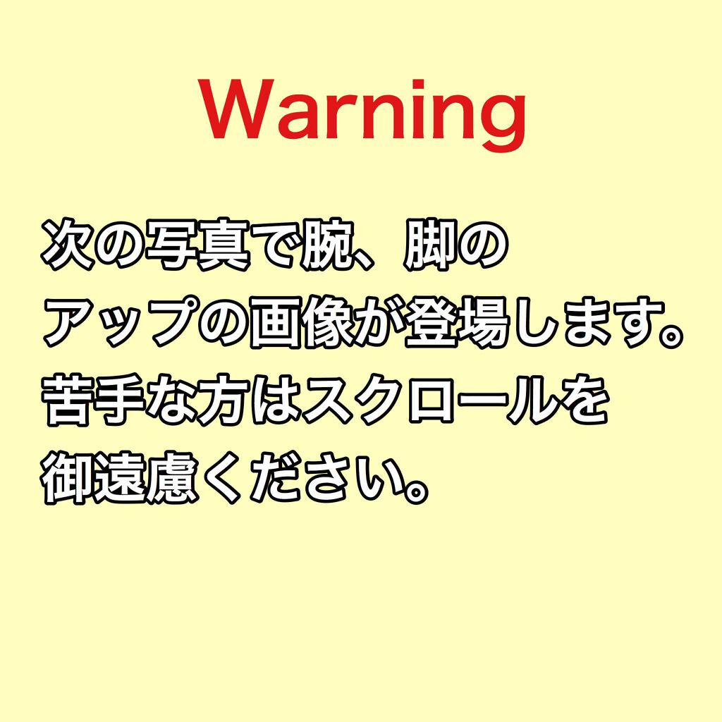 アイスレディ/icelady/家庭用脱毛器を使ったクチコミ（2枚目）