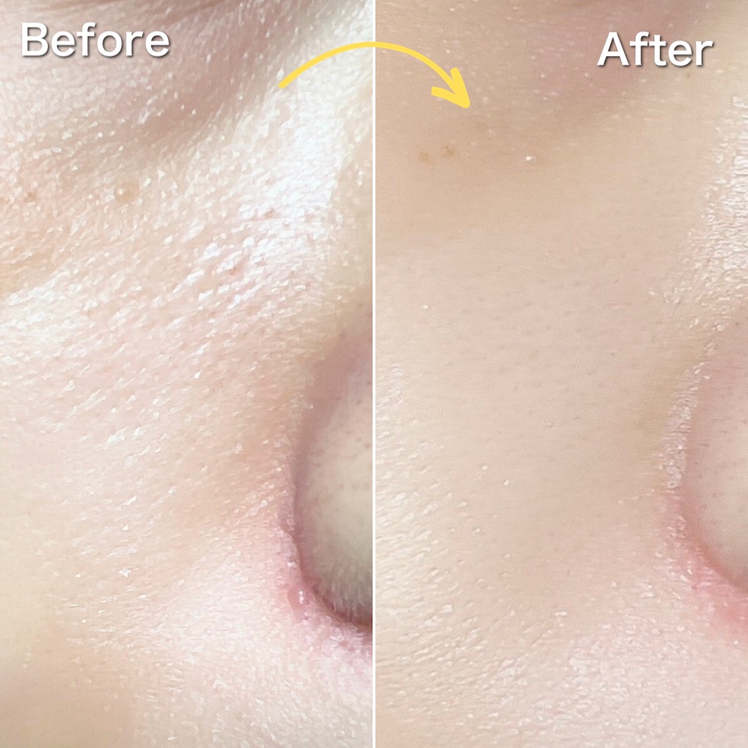 3番 集中ケアレチノール美容液/numbuzin/美容液を使ったクチコミ（3枚目）