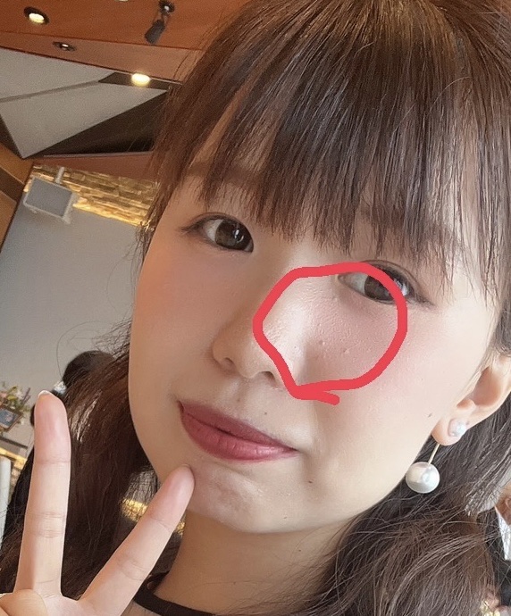 オーガニック ハトムギエキス (ヨクイニン)/KISO/その他を使ったクチコミ（3枚目）