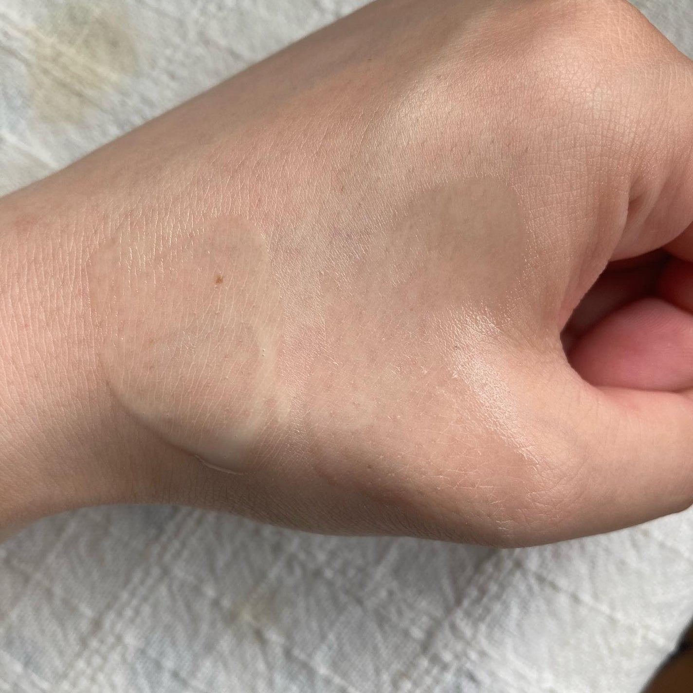 シカレチA エッセンス0.1/VT/美容液を使ったクチコミ(6枚目)