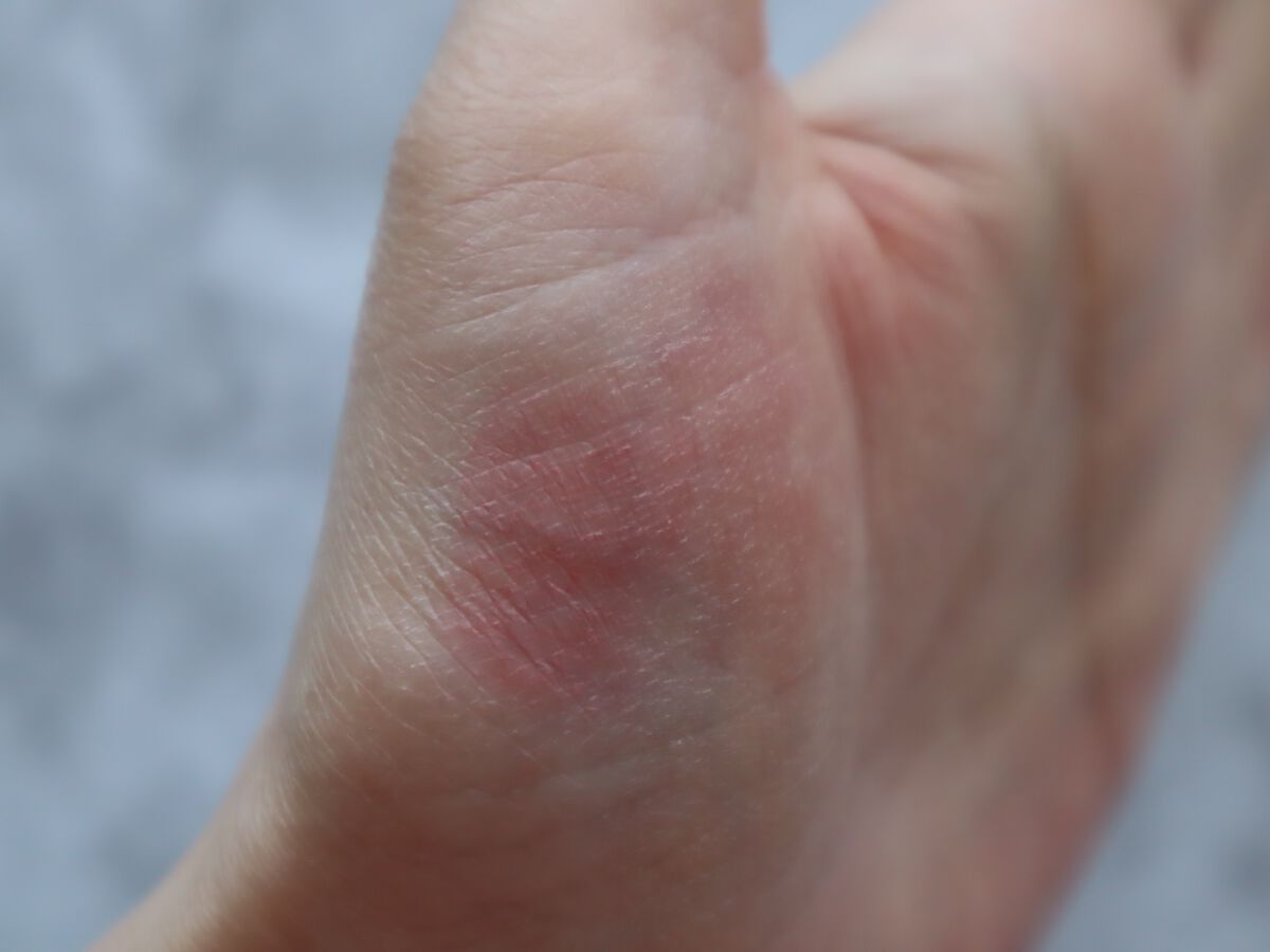 リールタトゥーグラスティント /MERYTHOD/リップティントを使ったクチコミ(5枚目)