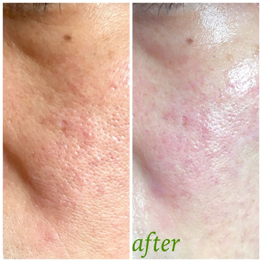 高浸透うるおい部分用マスク/SQS/シートマスク・パックを使ったクチコミ（2枚目）