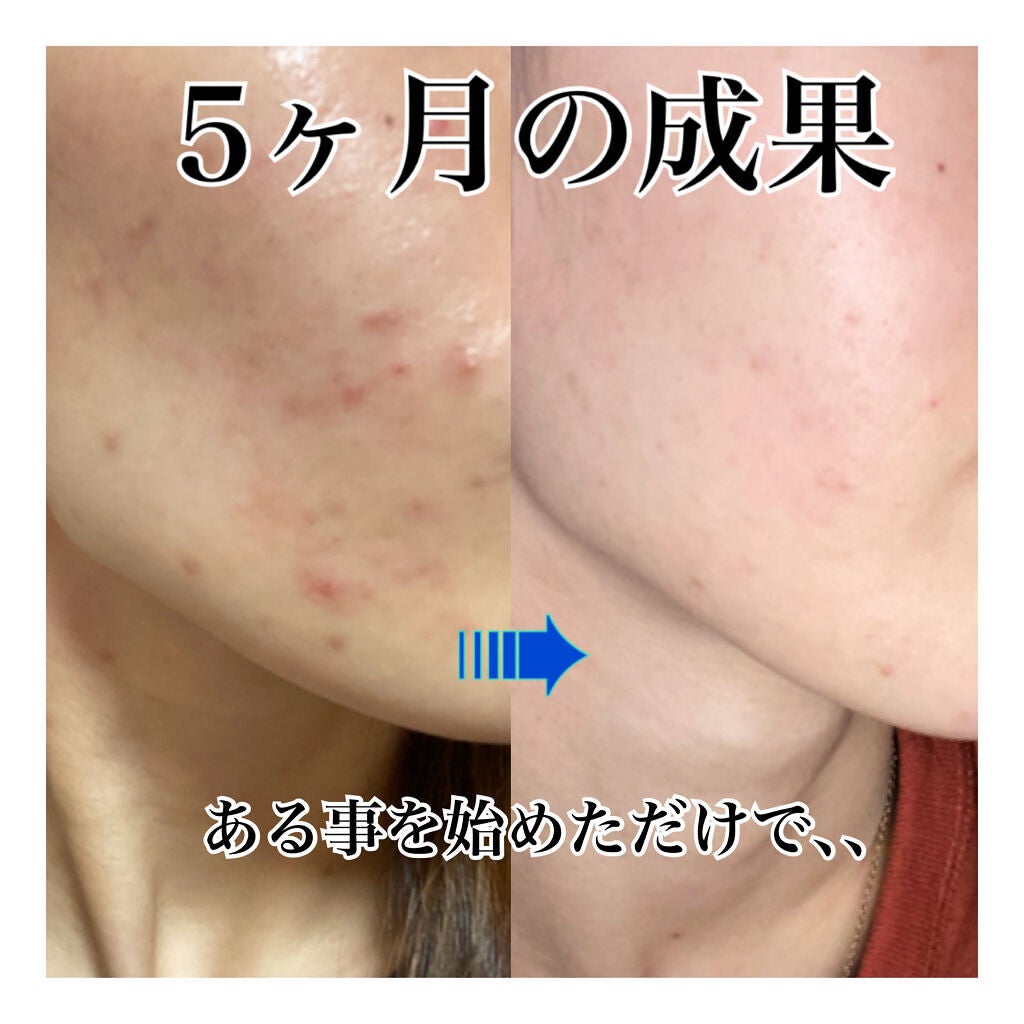 DHC ビタミンBミックス/DHC/美容サプリメントを使ったクチコミ(1枚目)