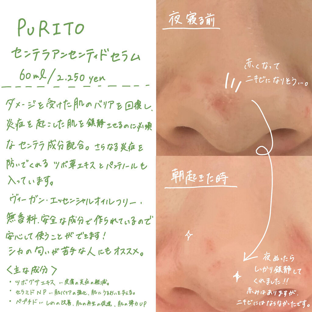 センテラアンセンティドセラム/PURITO/美容液を使ったクチコミ（3枚目）