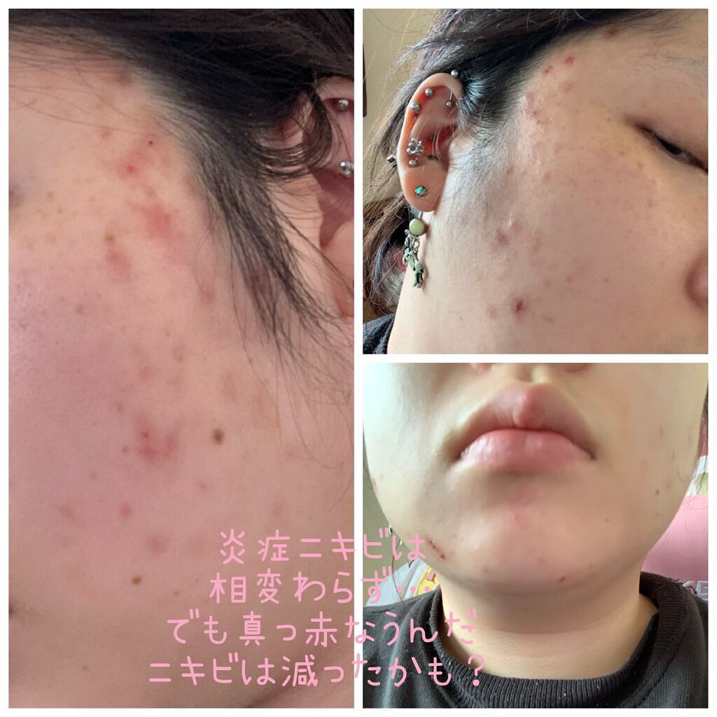 CICAフェイスクリーム/ピコモンテ/フェイスクリームを使ったクチコミ（3枚目）