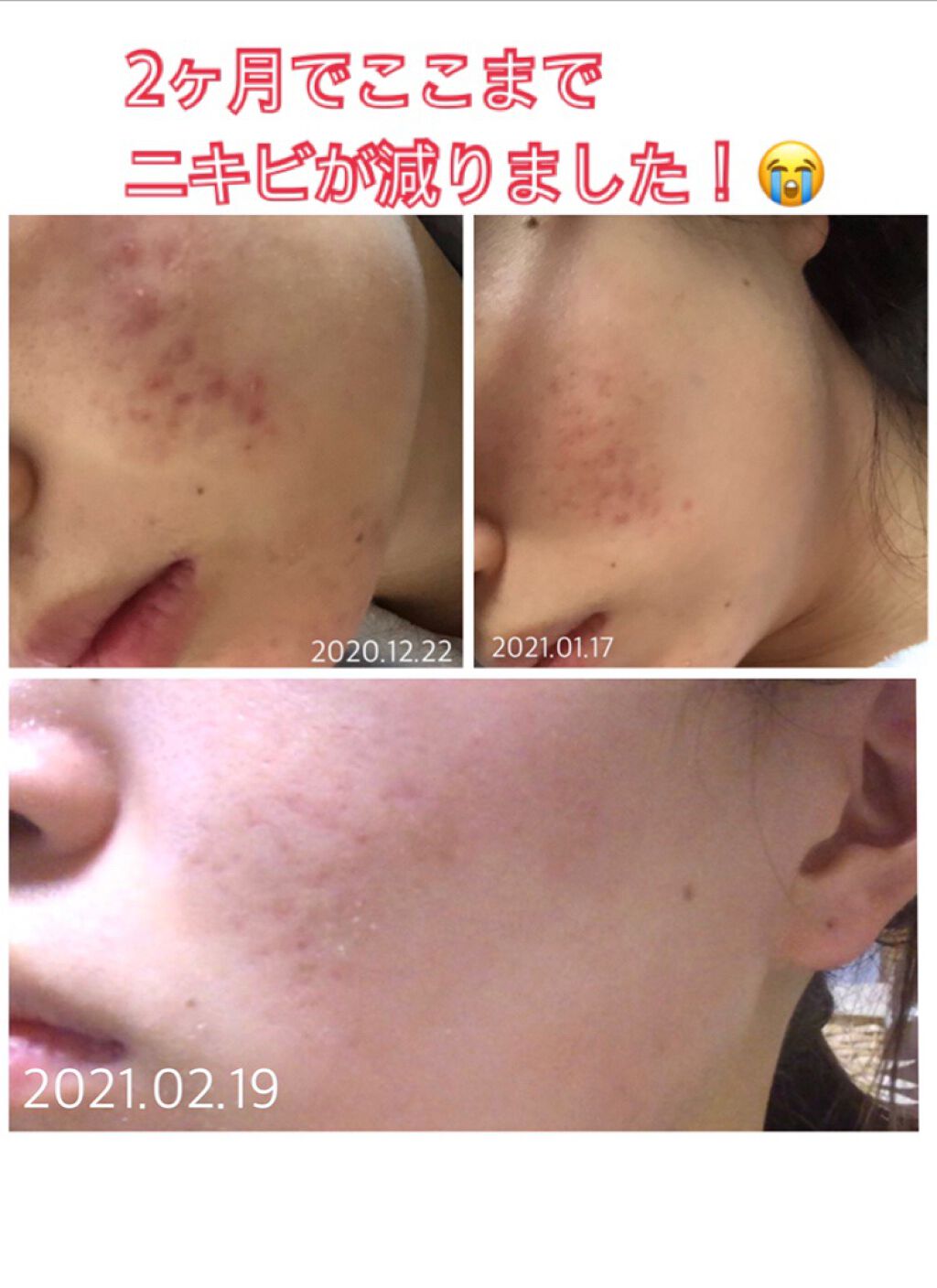 ジェルメイク落とし/キュレル/クレンジングジェルを使ったクチコミ(1枚目)