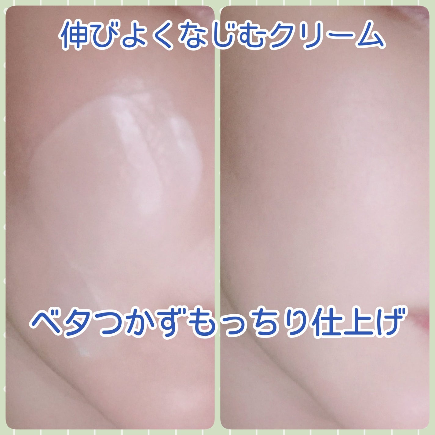 アキュリアルナインコントロールエックスクリーム/ACWELL/フェイスクリームを使ったクチコミ(3枚目)