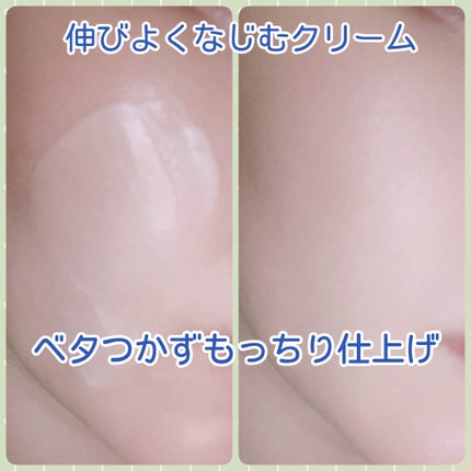 アキュリアルナインコントロールエックスクリーム/ACWELL/フェイスクリームを使ったクチコミ(3枚目)