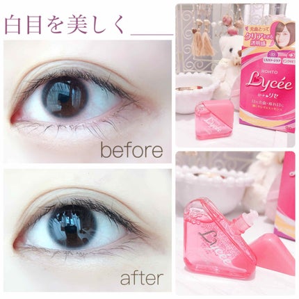 ロートリセ(医薬品)/ロート製薬/その他を使ったクチコミ(1枚目)