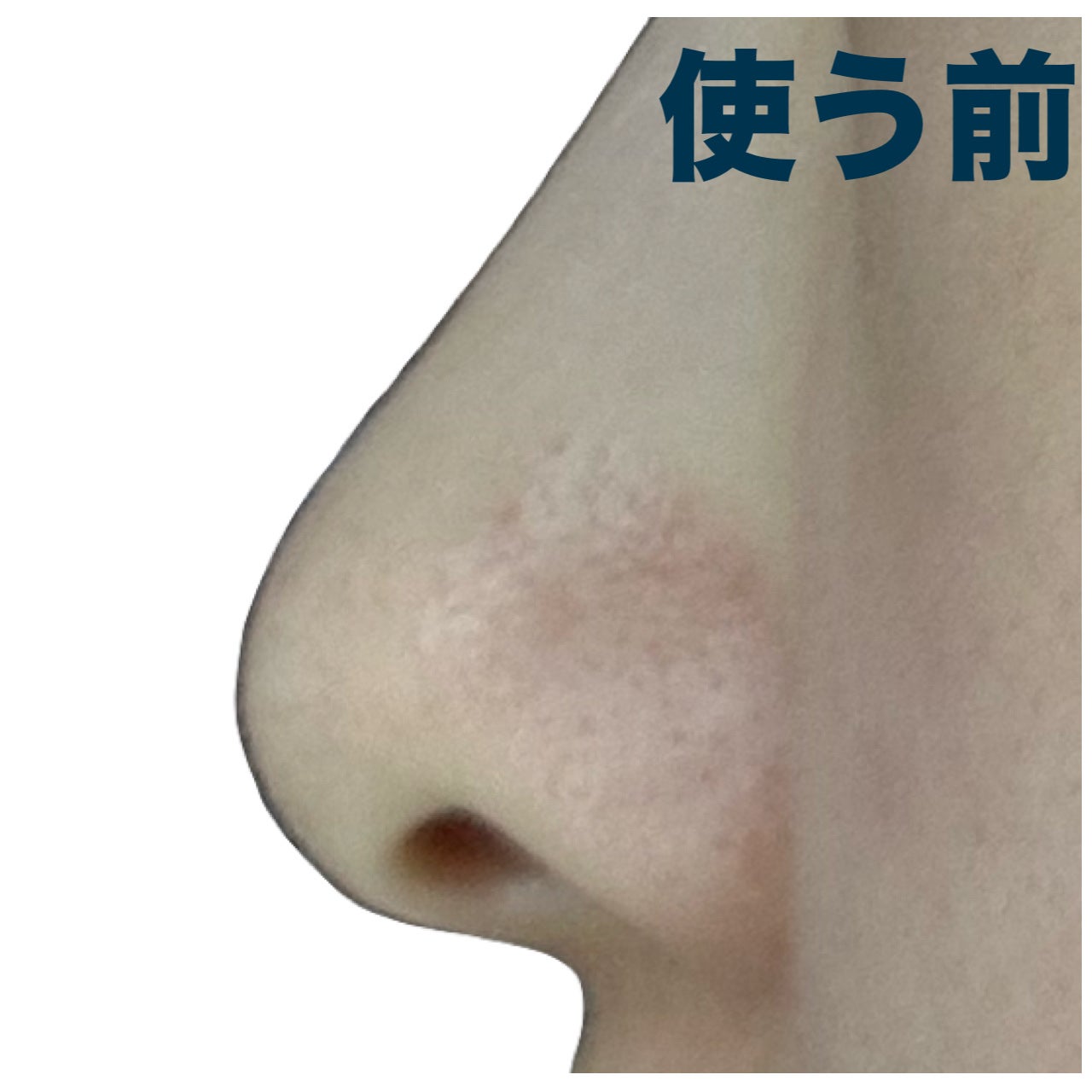 ノーズピーリングパック/One-day's you/シートマスク・パックを使ったクチコミ(4枚目)