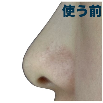 ノーズピーリングパック/One-day's you/シートマスク・パックを使ったクチコミ(4枚目)