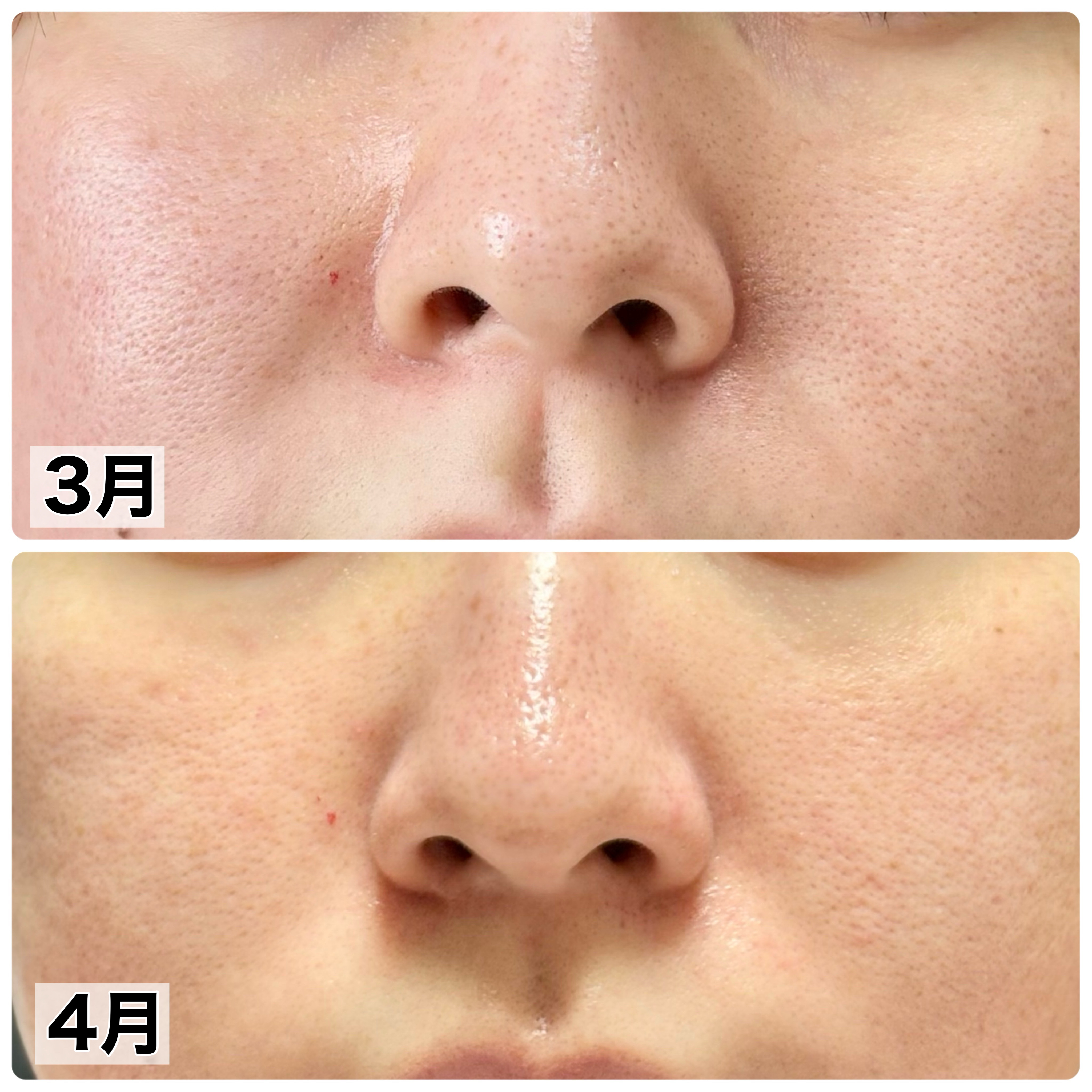 ビオレ ザフェイス 泡洗顔料 スムースクリア/ビオレ/泡洗顔を使ったクチコミ（2枚目）