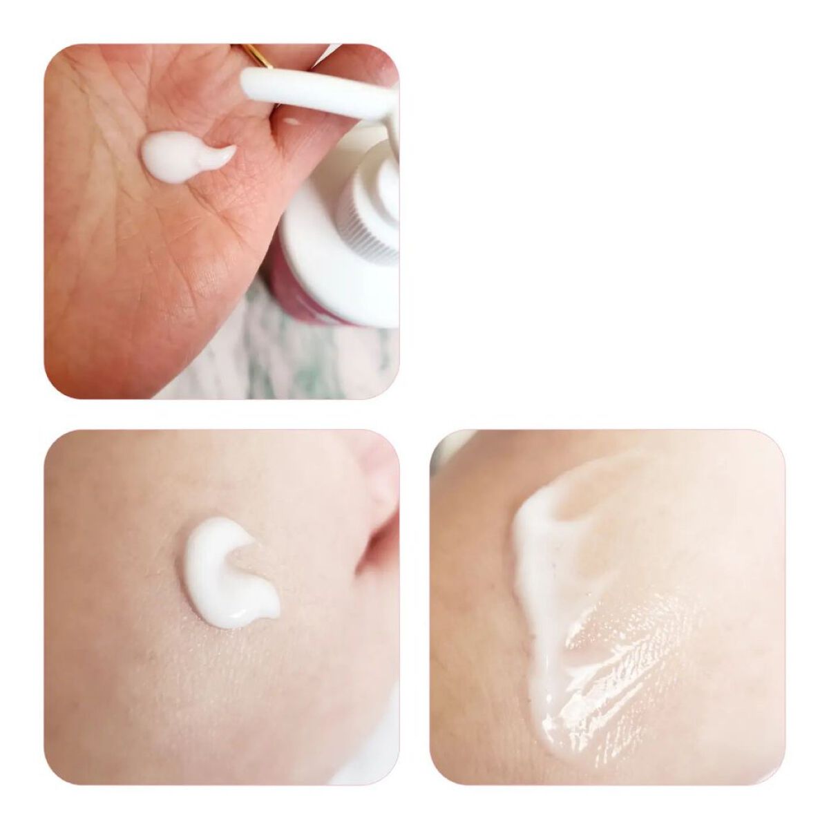 ヘパトリート 薬用保湿ミルククリーム/ゼトックスタイル/ボディクリームを使ったクチコミ（2枚目）