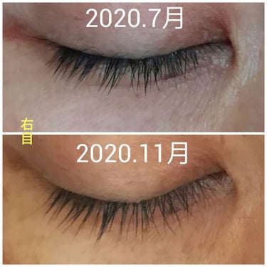 FEG  Eyelash  Enhancer/FEG/まつげ美容液を使ったクチコミ（2枚目）