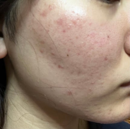 を使ったクチコミ(2枚目)