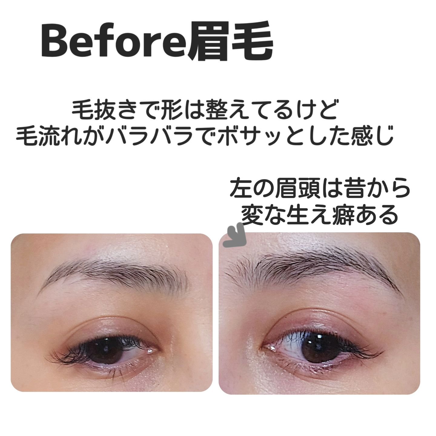 タフブローリフトキット/ENTROPY/その他キットセットを使ったクチコミ（2枚目）