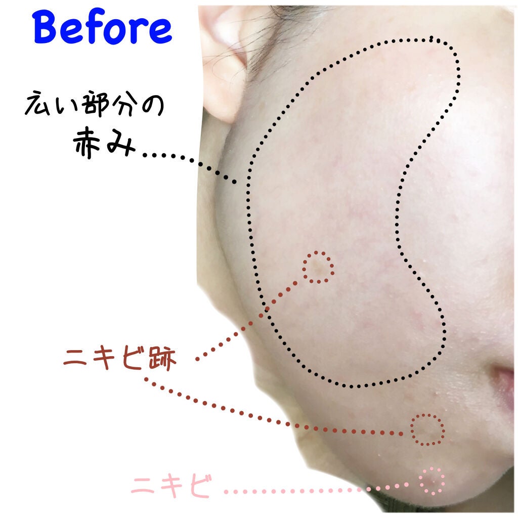 マスクフィットオールカバークッション/TIRTIR(ティルティル)/クッションファンデーションを使ったクチコミ(5枚目)