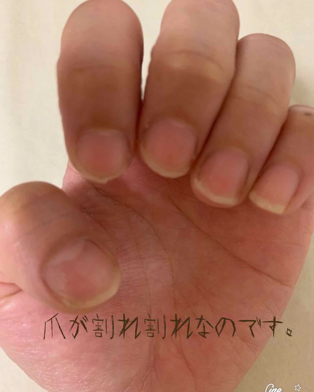 オーガニックビューティーオイルネイルフローラルシトラス/生活の木/ネイルオイル・トリートメントを使ったクチコミ(2枚目)