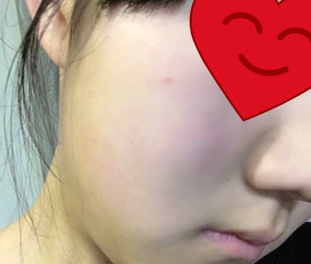 ハトムギエキス化粧水/プラチナレーベル/化粧水を使ったクチコミ(2枚目)