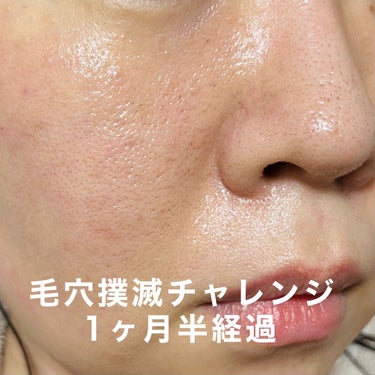 Vitamin C Suspension 23% + HA Spheres 2%/The Ordinary/美容液を使ったクチコミ（1枚目）