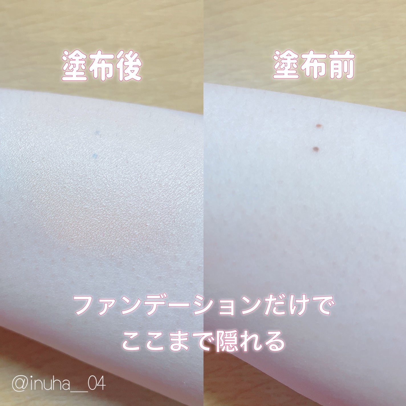 クリオ キル カバー スキン フィクサー クッション/CLIO/クッションファンデーションを使ったクチコミ(5枚目)