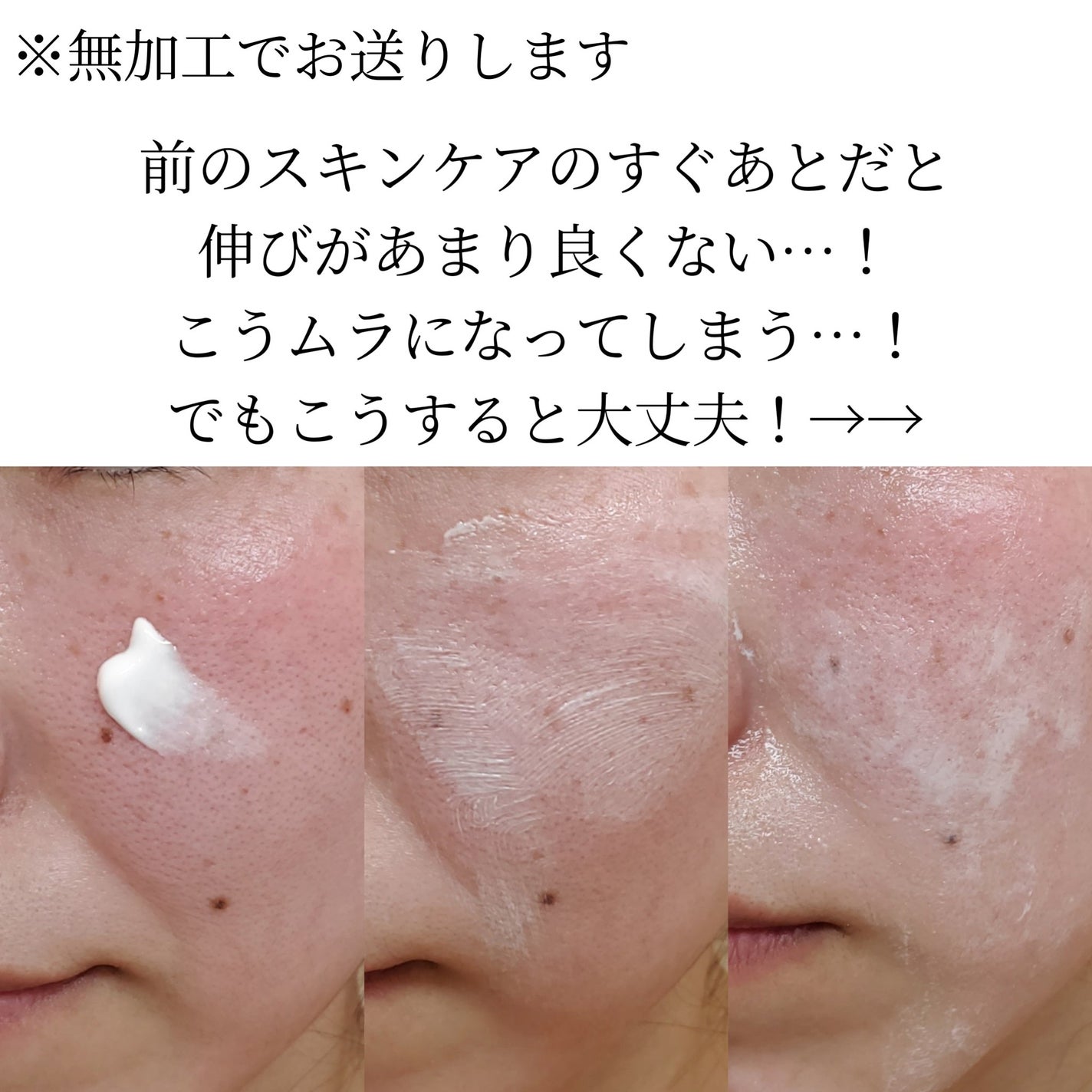 CUREPAIR MELA CREAM /KOPHER/フェイスクリームを使ったクチコミ(5枚目)