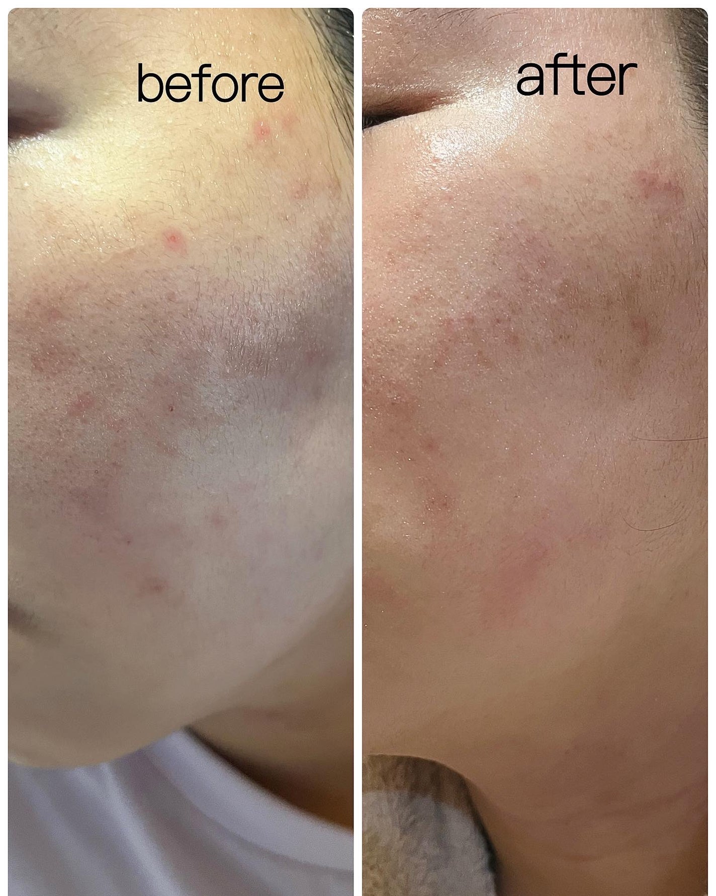 131 ポア クリアリング セラム/Celladix/美容液を使ったクチコミ(3枚目)