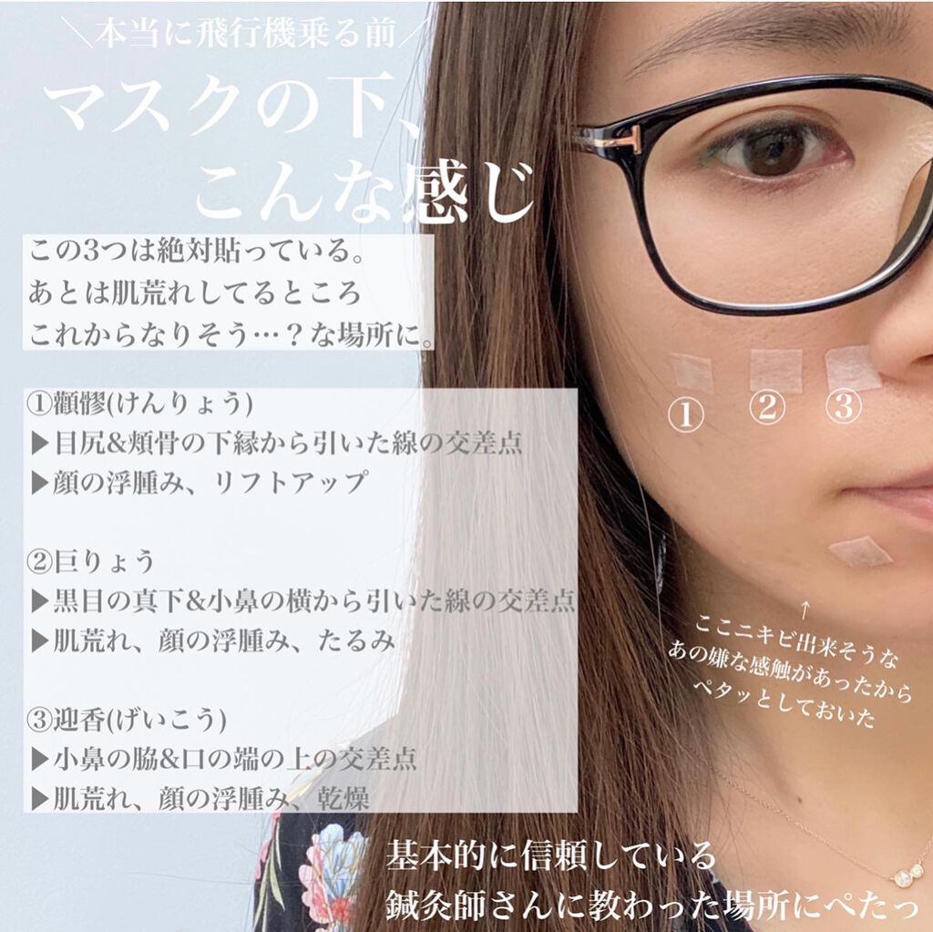 円皮鍼/セイリン/その他を使ったクチコミ(5枚目)