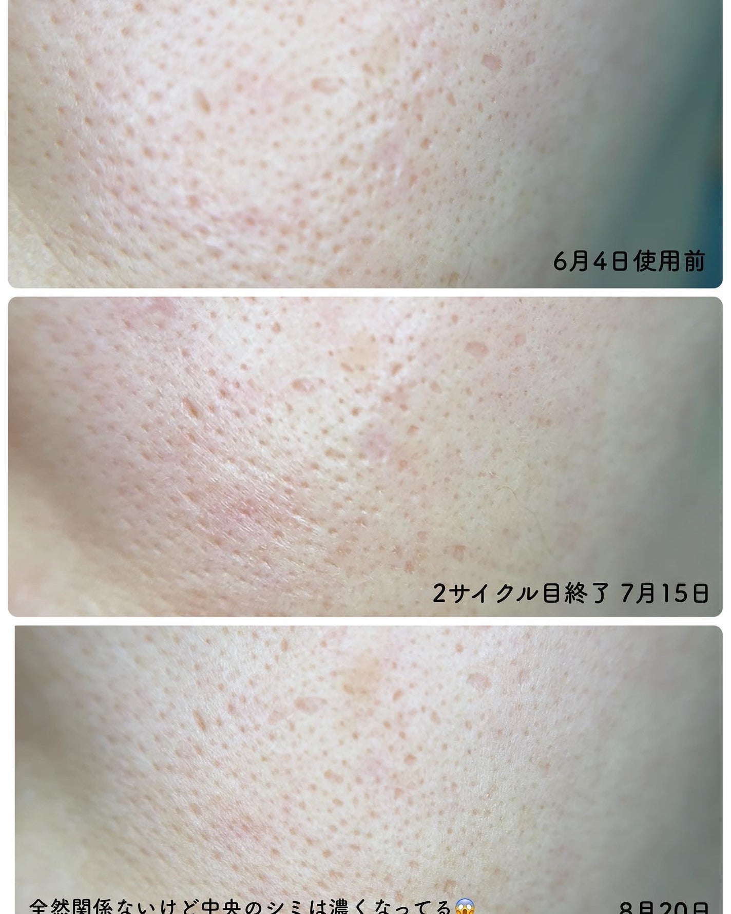 リードルショット300/VT/美容液を使ったクチコミ(3枚目)