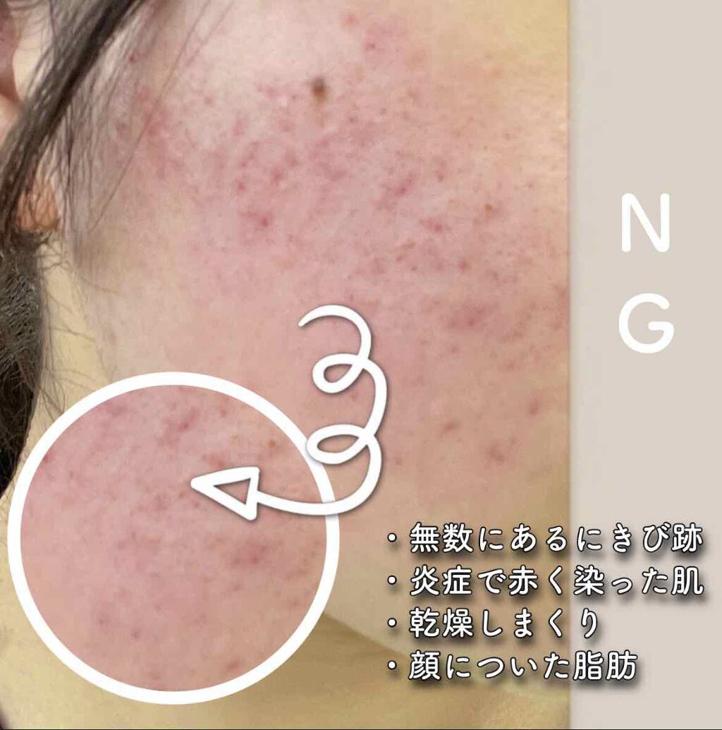 ディープピュア洗顔料/ダヴ/洗顔フォームを使ったクチコミ（3枚目）