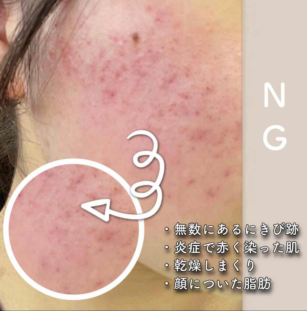 ハトムギ保湿ジェル(ナチュリエ スキンコンディショニングジェル)/ナチュリエ/美容液を使ったクチコミ(3枚目)