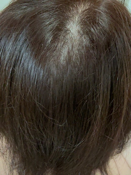 HYPERLINK SERUM/MEDULLA/アウトバストリートメントを使ったクチコミ(4枚目)