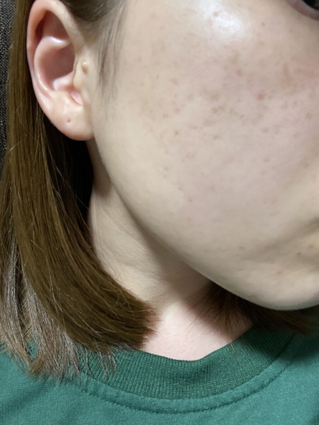 モイスチャー リッチローション(とてもしっとり)/アルージェ/化粧水を使ったクチコミ（2枚目）