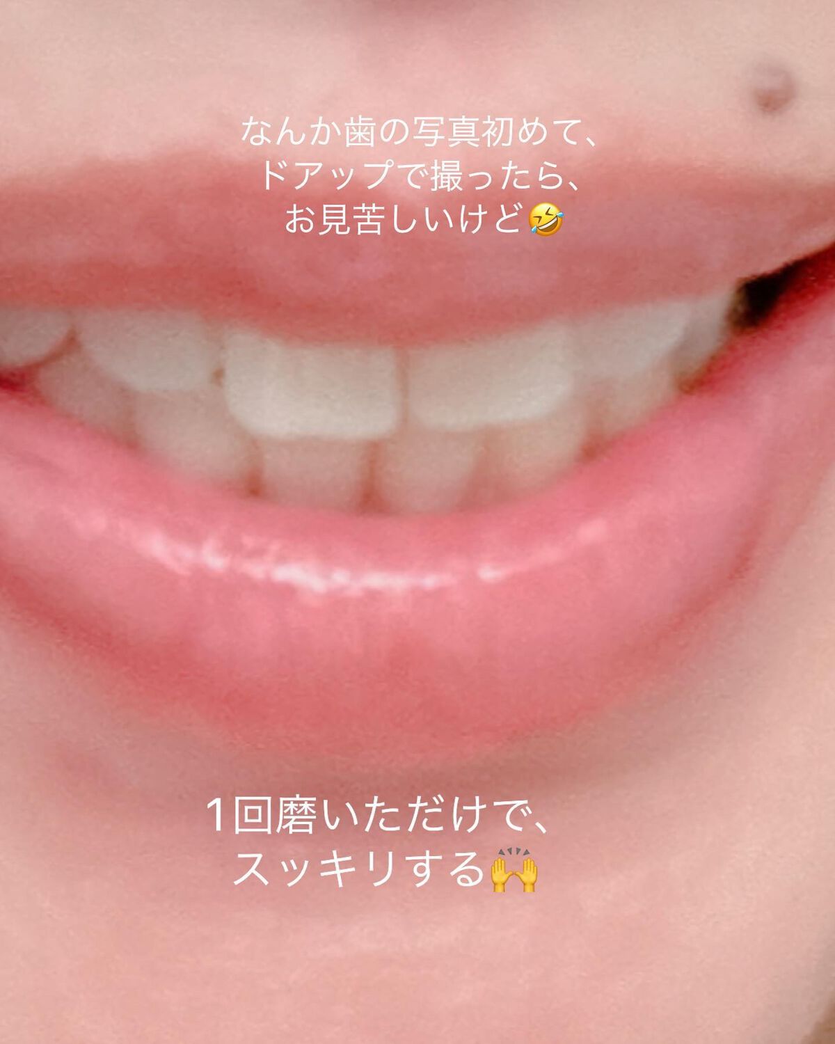 ホワイトニングペースト/Smile Cosmetique/歯磨き粉を使ったクチコミ(4枚目)