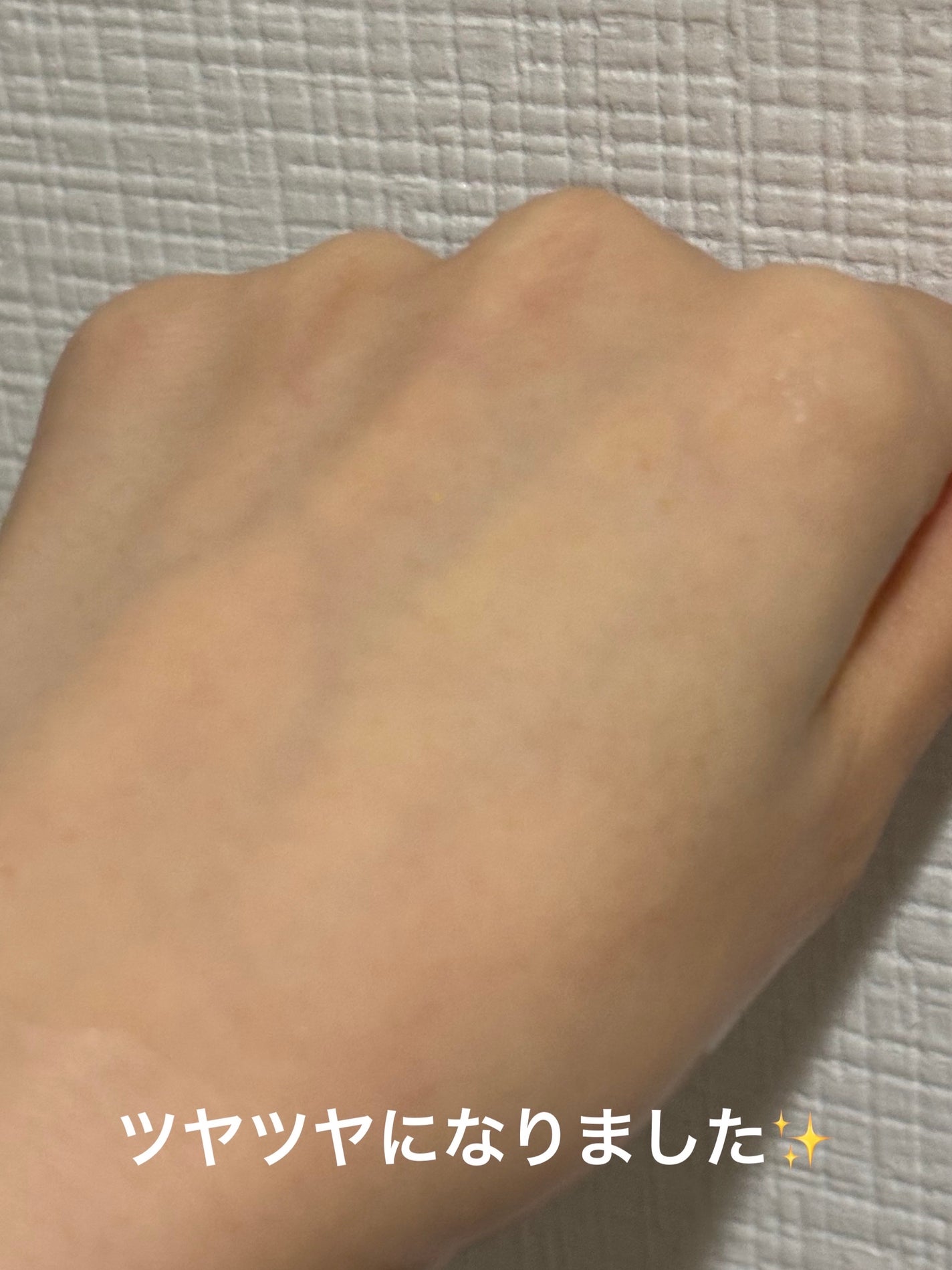 エンリッチ LGピール/ドクターシーラボⓇ/ピーリングを使ったクチコミ(5枚目)