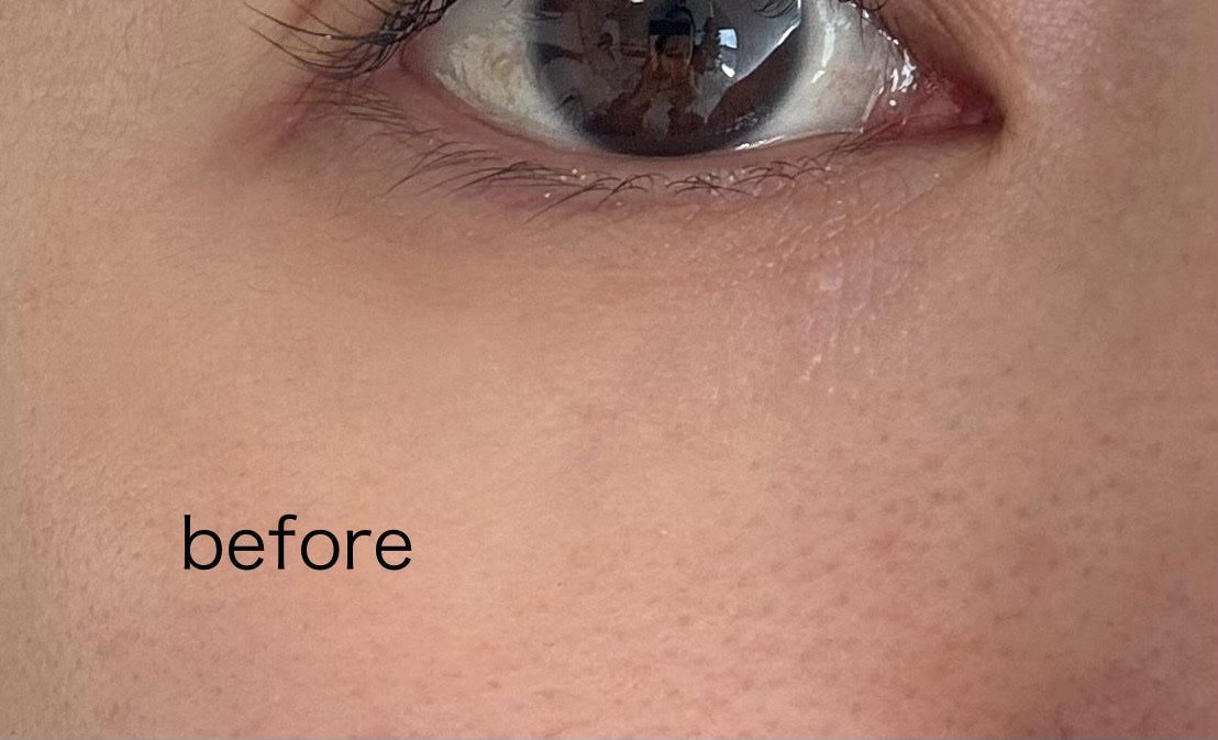 アイレノール クマクリーム/IRENOL/アイケア・アイクリームを使ったクチコミ(3枚目)