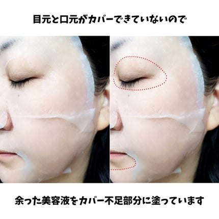 ティーツリーケア ソリューション エッセンシャルマスクEX/MEDIHEAL/シートマスク・パックを使ったクチコミ(4枚目)