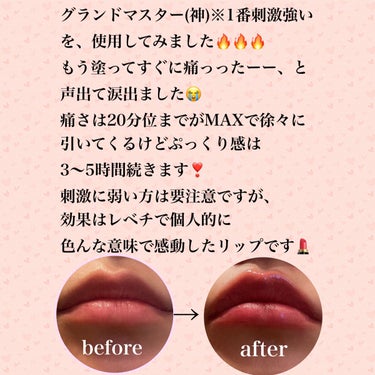 ✼••┈┈••✼••┈┈••✼••┈┈••✼••┈┈••✼
keybo
DOTOM Lip Plus Plumper
グランドマスタースプリンググラス
✼••┈┈••✼••┈┈••✼••┈┈••✼••┈┈••✼


プランパーのピリピリ感が好きで、こちらは
ずっと気になっていて、リップスで購入出来たので
試してみました💄✨


ピリピリ成分(バニリルブチル)がMAXと
公式で記されていました😳


正直想像をだいぶ超えてきました。


塗った瞬間から痛くて思わず痛っったーーと
声出ました。
涙もボロボロでました🤣


ですが、ご覧の通りプランプ効果も凄いし
なんなら腫れて唇の血色も良くなっている😳❗️


そして、この痛さですが驚くことに
使い続けていると慣れてくる😱


ぷっくり感も長時間続くのでもうヒアル要らず
なのでは？とすら感じました。


痛さレベルも選べますし、カラバリも豊富なので
是非チェックしてみてください😊





 #推しリップ  

#フォロバ100 
#フォロバ
#フォロー返し
#相互フォロー
#いいね返し

 #私の上半期ベストコスメ2023 の画像 その1