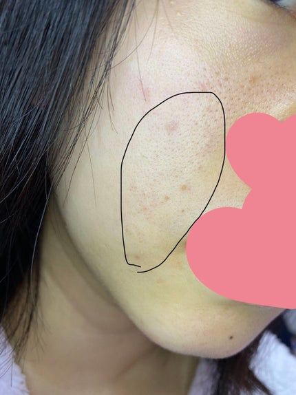 V エッセンス/unlabel/美容液を使ったクチコミ(4枚目)