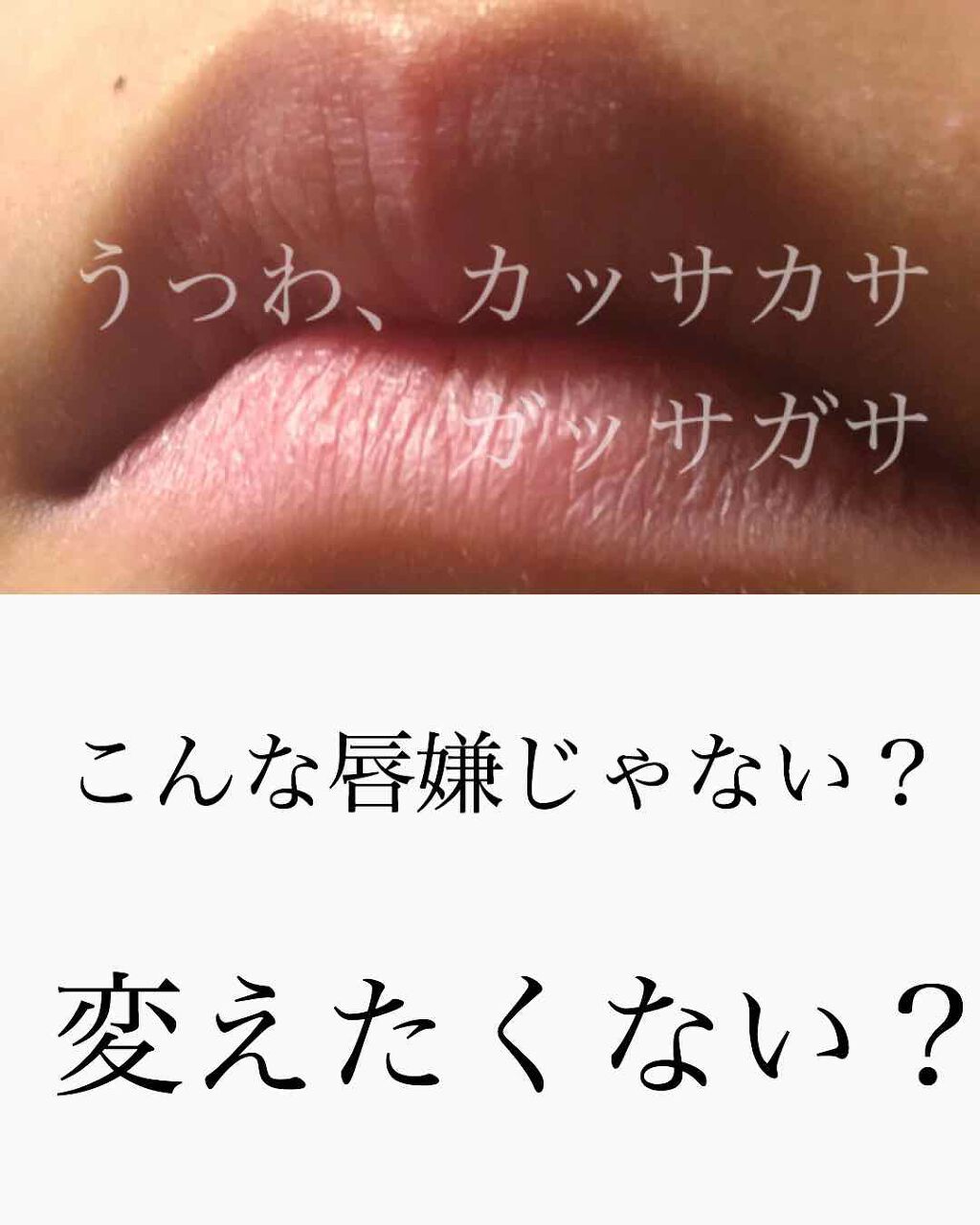 リップセラム/ヴァセリン/リップケアを使ったクチコミ(1枚目)