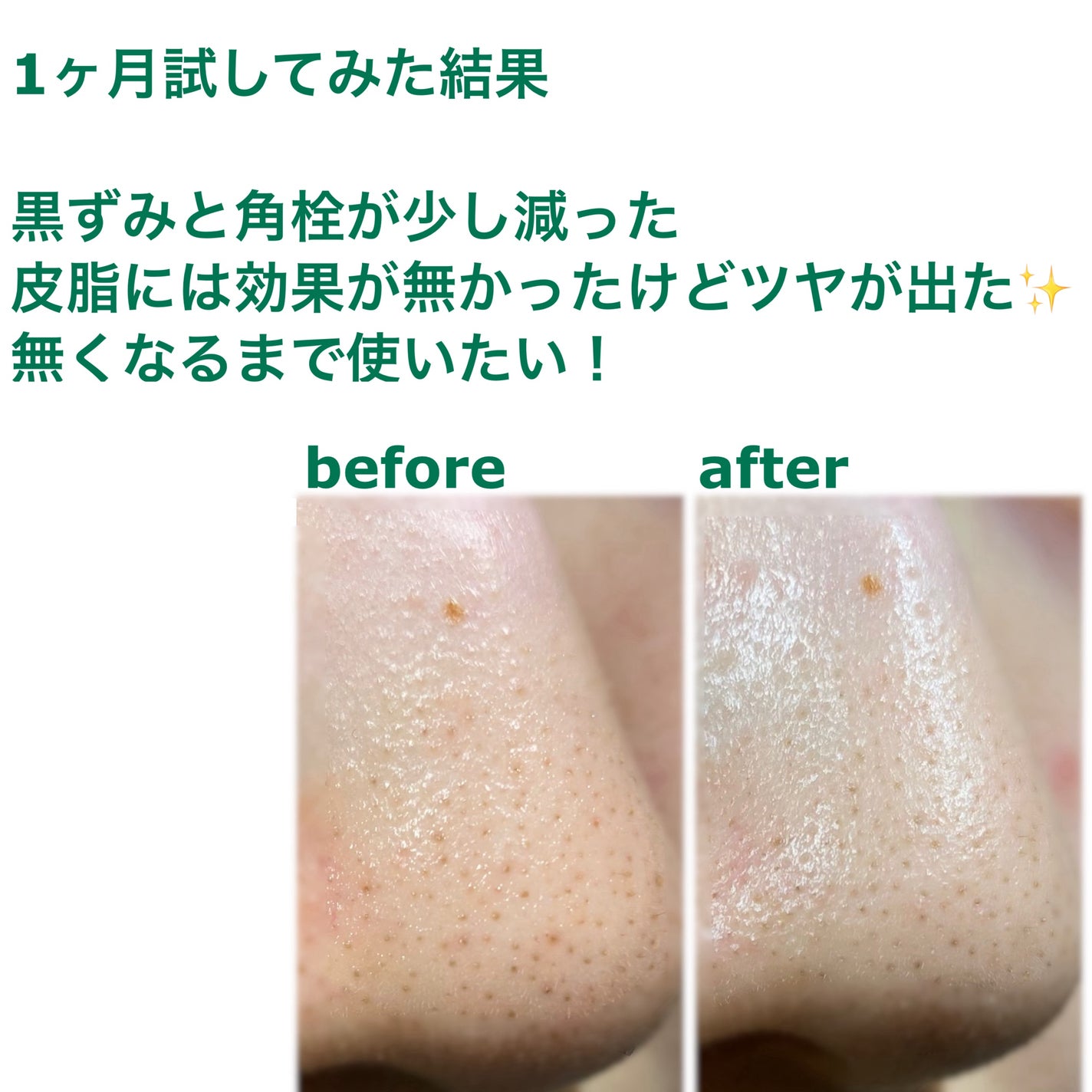 CICA マイルドフォームクレンザー/VT/洗顔フォームを使ったクチコミ(4枚目)