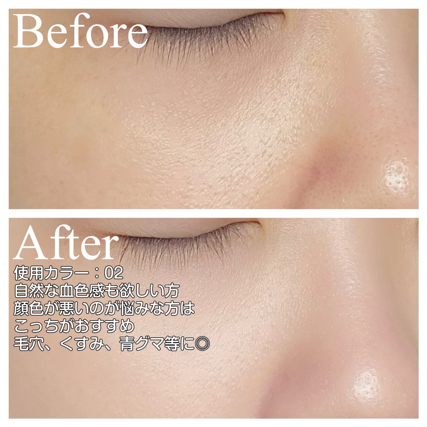 ã¢ã€ã¹ãããªãºã ãã©ã€ããŒ/ãã£ã³ã¡ã€ã¯/åç²§äžå°ã䜿ã£ãã¯ãã³ãïŒ6æç®ïŒ